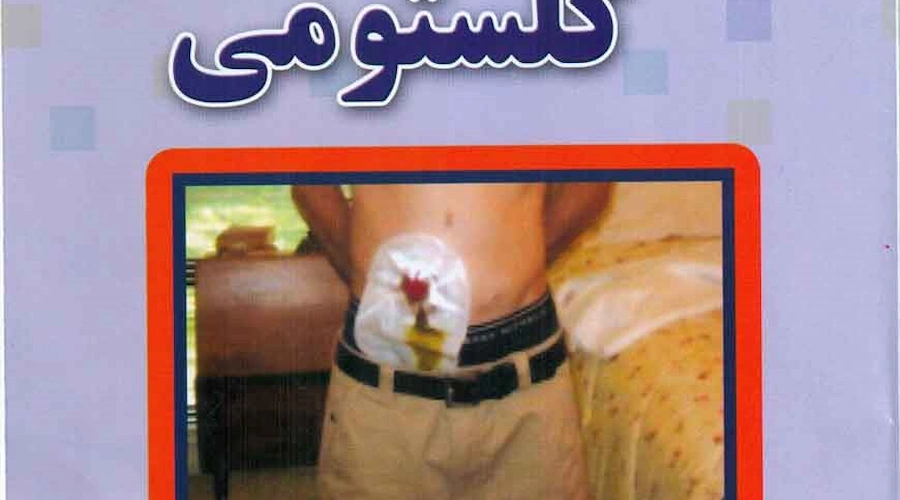 کلستومی